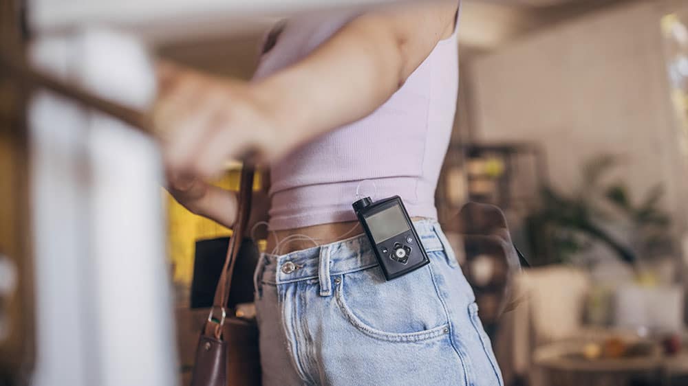 Woman wearing an insulin pump attached to her jeans